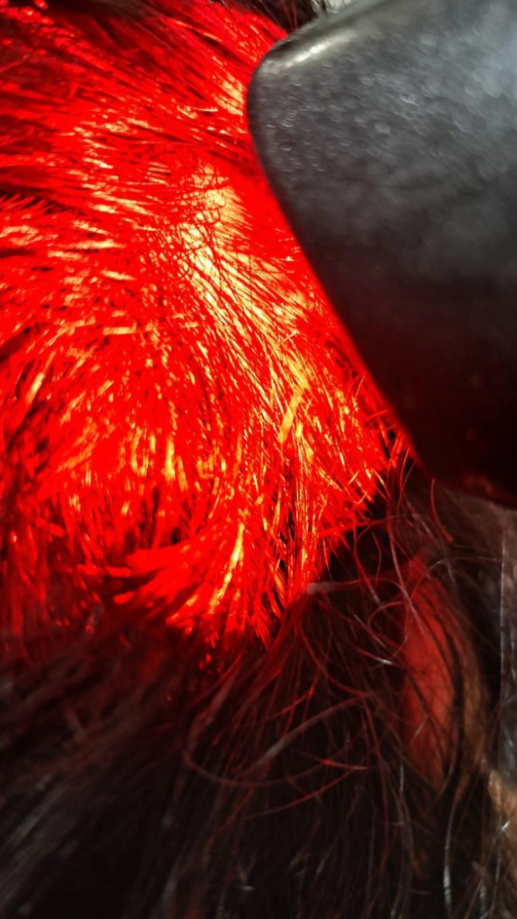 Ledterapia — tratamento com luz vermelha no couro cabeludo